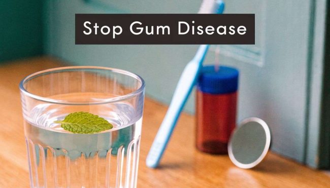 how-to-prevent-gum-disease-from-getting-worse-dental-hygiene Promotional banner 'Stop Gum Disease' above a glass of water with a mint leaf and dental items on a wooden surface (toothbrush, bottle, cap).