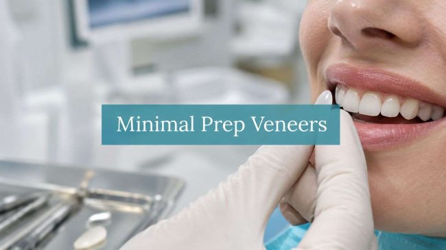 minimal-prep-veneers-dental-procedure Close-up of a dentist placing a veneer on a patient’s teeth, with the overlay text 'Minimal Prep Veneers' across the image